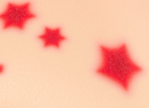 angioma stellato tutto quello che devi sapere 1746427046